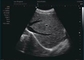 गर्भावस्था में डॉपलर अल्ट्रासाउंड होम डॉपलर अल्ट्रासाउंड जांच फ्रीक्वेंसी 12 मेगाहर्ट्ज
